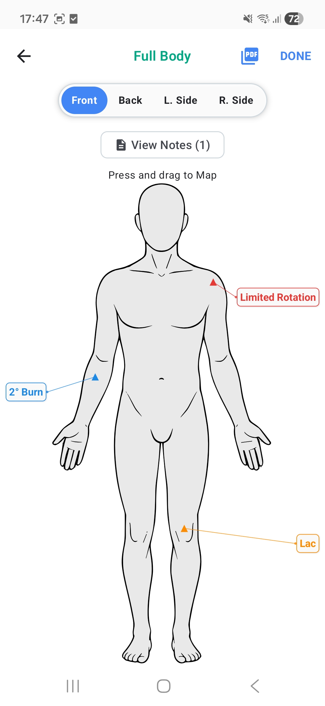 Body Maps